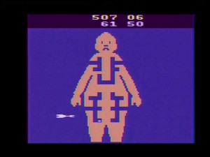 mash atari 2600 gameplay